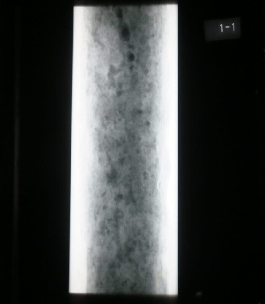 排水管の劣化診断